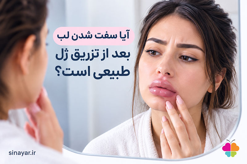 آیا سفت شدن لب بعد از تزریق ژل طبیعی است؟