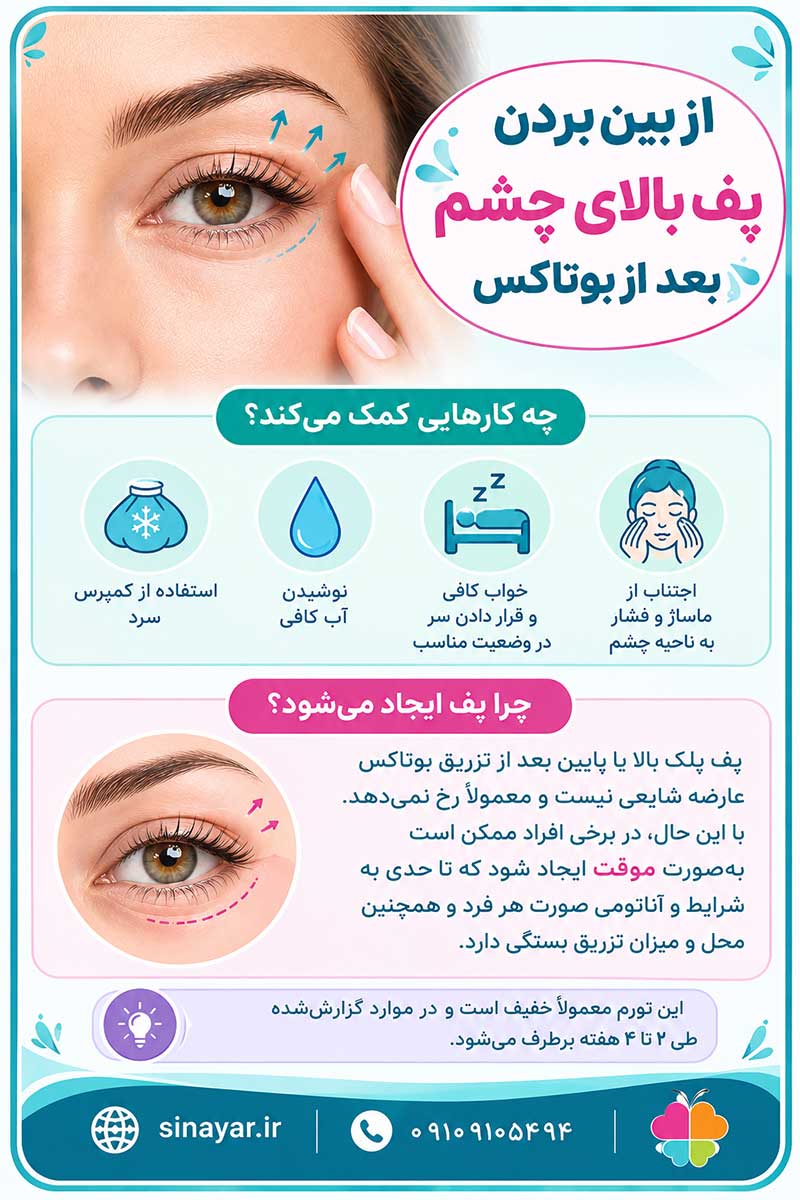 از بین بردن پف بالای چشم بعد از بوتاکس
