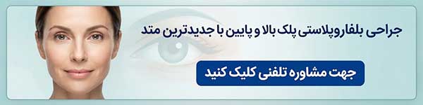 مشاوره بلفاروپلاستی