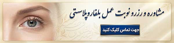 مشاوره بلفاروپلاستی