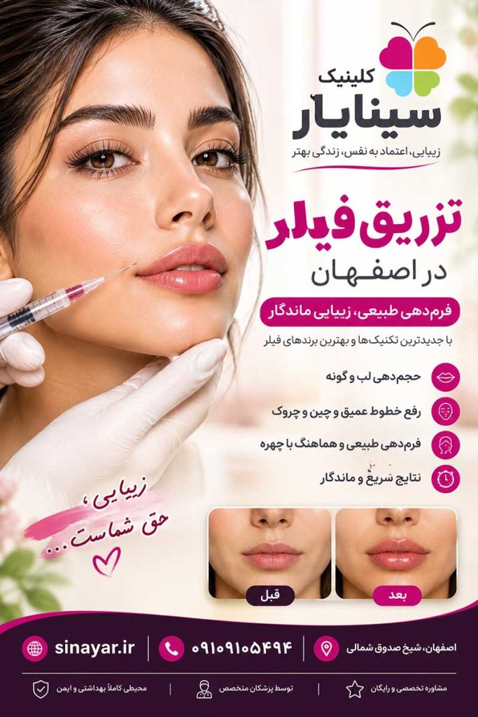 تزریق فیلر در اصفهان