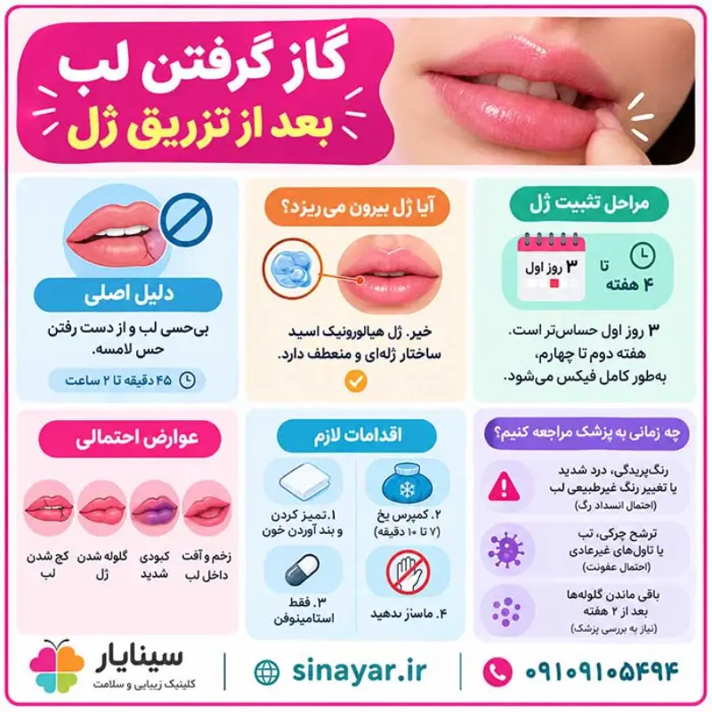 گاز گرفتن لب بعد از تزریق ژل