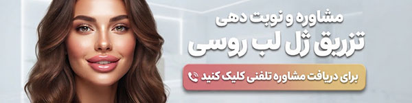 بهترین دکتر ژل لب روسی در اصفهان