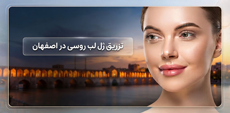 تزریق ژل لب روسی در اصفهان